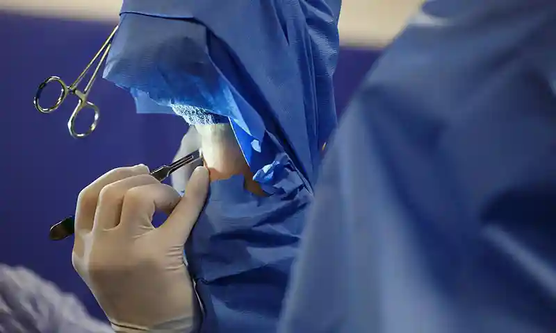 A surgical procedure